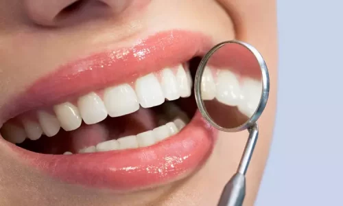 dental costs with and without insurance