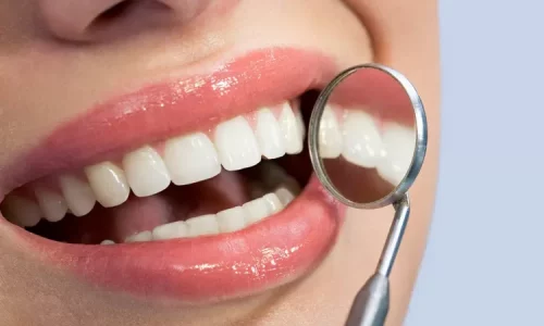 Closeup Of Dental Mirror In Woman's Mouth